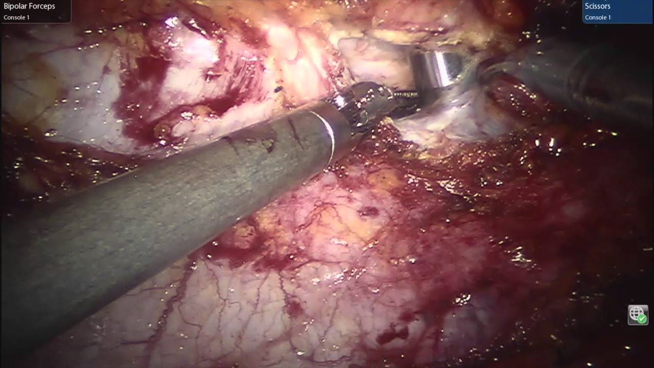 video phone lyrics Robotic Component Separation / TAR