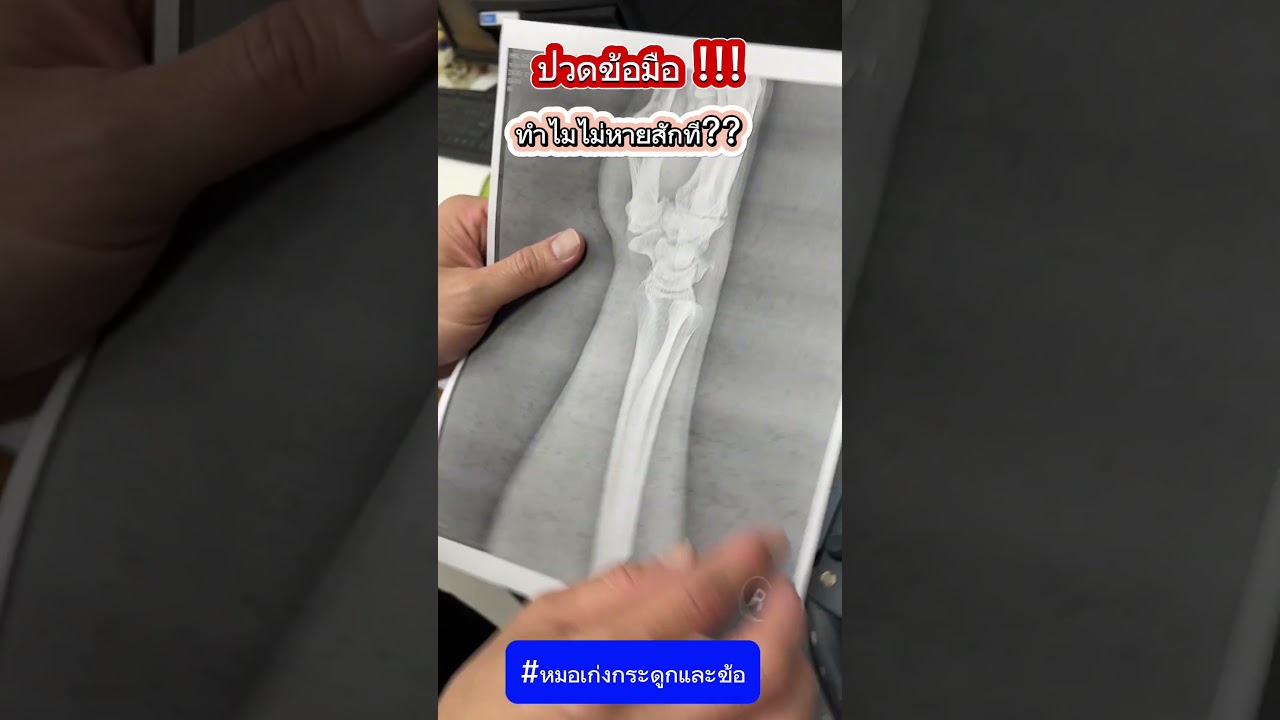 ปวดข้อมือ ทำไมไม่หายสักที #หมอเก่งกระดูกและข้อ #ปวดข้อมือ #ข้ออักเสบ #ข้อมืออักเสบ