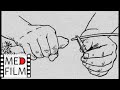 Катетеризация мочевого пузыря © Urinary catheterization