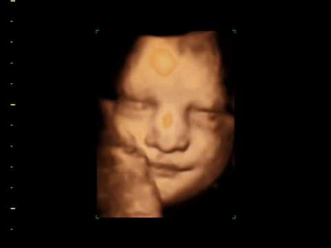 eyes wide open Beautiful 3D 4D baby bonding scan