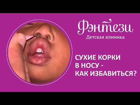 👃  Сухие корки в носу - как избавиться?