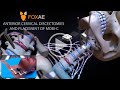 Anterior Cervical Discectomy and Fusion | Legal Animation | Surgery Demonstration
