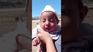 Masaje Labial De Bebé Operado De Labio Leporino