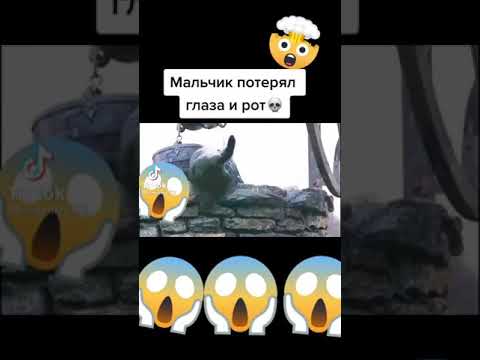 Этот мальчик потерял лицо😱