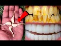 2 मिनट में गंदे पीले दांतो को मोती की तरह सफेद और चमकदार बना देगा ये नुस्खा // teeth whitening