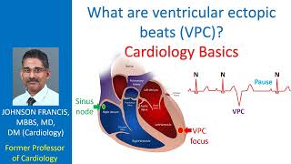 What are ventricular ectopic beats (VPC)? Cardiology Basics