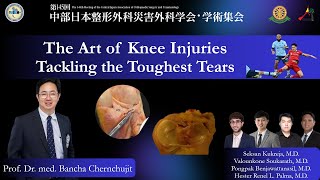 The Art of Knee Injury: Tackling the Toughest Tears Prof.Bancha Chernchujit ศ.นพ.บัญชา ชื่นชูจิตต์