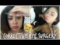 MY HONEST PRK (VISION CORRECTION) EXPERIENCE | The Good, The Bad, and The Ugly!