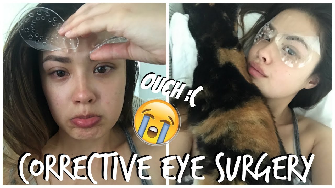 МОЙ ЧЕСТНЫЙ ОПЫТ ФРК (КОРРЕКЦИИ ЗРЕНИЯ) | Хорошее, плохое, злое!