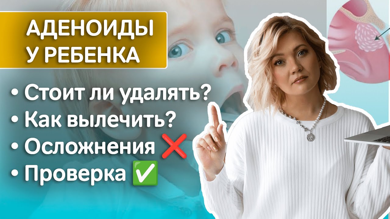 АДЕНОИДЫ у ребенка: причины, симптомы, ошибки в лечении, удаление, риски, как вылечить дома маме