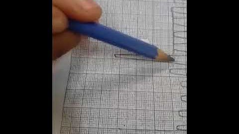 Respiration curve Dr Mohamed Fayez