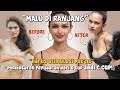 FROM 0 CUP TO C CUP🍒 Setelah Breast Augmentation jadi SEXY BANGET🤩🤤