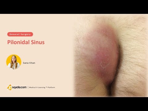 Video: Hard Anus: Príčiny, Príznaky A Liečba