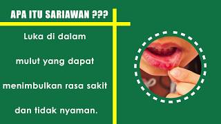 Info Penyakit Sariawan RS Islam Surabaya - A. Yani