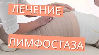 Единственный метод лечения лимфостаза. Лимфедема. Флеболог и лимфолог Москва.