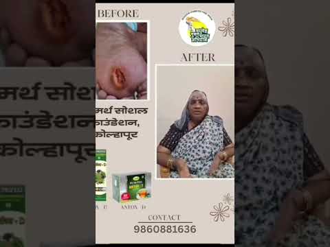 ANTOX-D ANTOX-TEA शुगर साठी जबरदस्त रिझल्ट आला आहे 💯 - YouTube