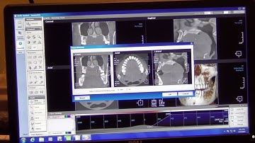05 - LED Dental - Rayscan - Imaging Software Overview