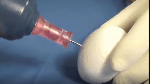 Arrow® EZ-IO® System Egg Demonstration Video