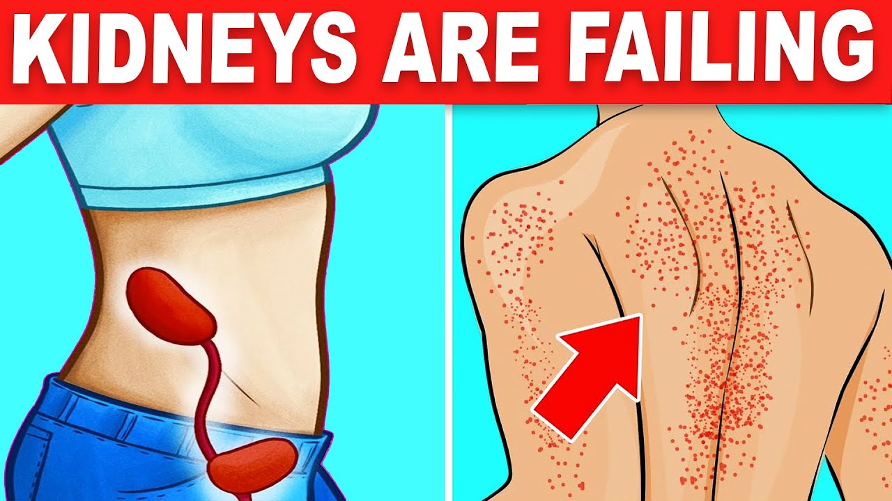 10 Signs Your Kidneys Are Crying For Help