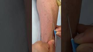 Intramuscular Injection Technique Explained | Safe IM Injection Step-by-Step |Nurse Guide Class N 70