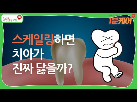   1분케어 스케일링하면 치아가 진짜 닳을까