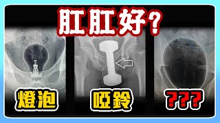 盤點塞進過肛門的龐然大物 拜託先不要... by 蒼藍鴿的醫學天地 312,935 views 1 month ago 6 minutes, 2 seconds