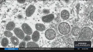 Newsom declares state of emergency over monkeypox