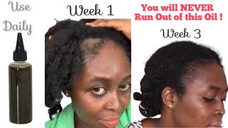 GROW YOUR EDGES BACK IN 2 WEEKS ! Edges regrowth Galore! 😳