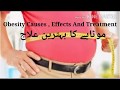 Obesity causes  effects  and treatment by hakeem mubasher ali hassan