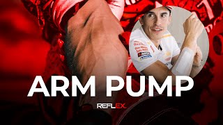 MotoGP | อาการบาดเจ็บ Arm pump ที่นักบิดหลายคนต้องเจอ!