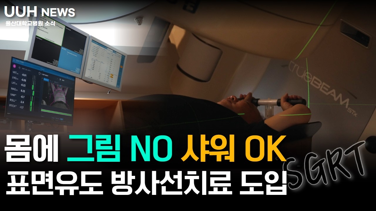 샤워도 못 했던 암 치료… 이제 달라집니다! SGRT 방사선치료 시스템 도입 | UUH 뉴스 6월