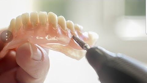 DIY demo video home adjustments on dentures and DenSureFit(Russell Klein dentures)