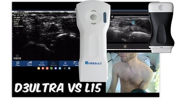 Handheld Ultrasound Wrist Scan—D3 Ultra vs Clarius