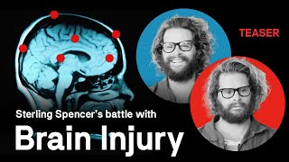 ARE YOU SERIOUS [Teaser]: Did you know Sterling Spencer had a Traumatic Brain Injury