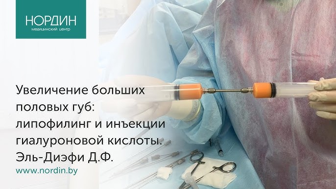 Строка навигации Хирургическое лечение ускоренного семяизвержения или как долго не кончать