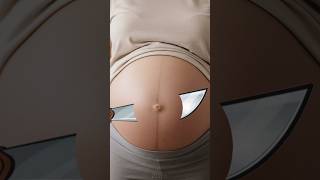 Whats Really Inside A Pregnant Belly?