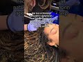 Hair loss or thinning? Here’s treatments to help #scalpfacial #prfhairrestoration #hairrestoration