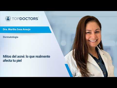 Mitos del acné: lo que realmente afecta tu piel