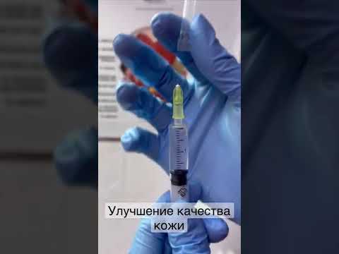 Мезотерапия лица