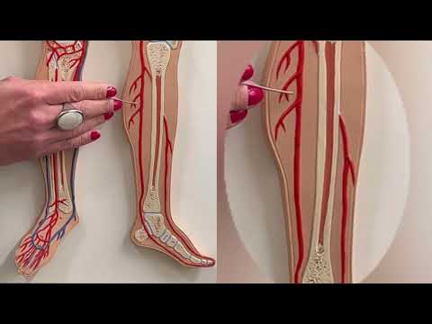 Dr. Benaduce: Lower Limb Arteries (Flat Model)