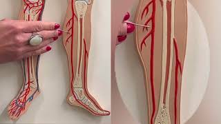 Dr. Benaduce: Lower Limb Arteries (Flat Model)
