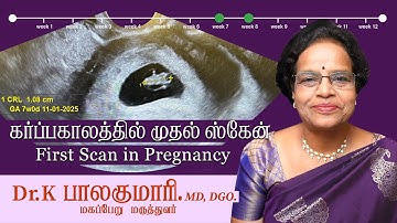 கர்ப்ப காலத்தில் முதல் ஸ்கேன்