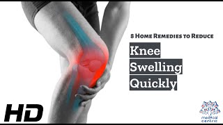 Knee Swelling Begone 8 Effective Home Remedies You Can Try Today