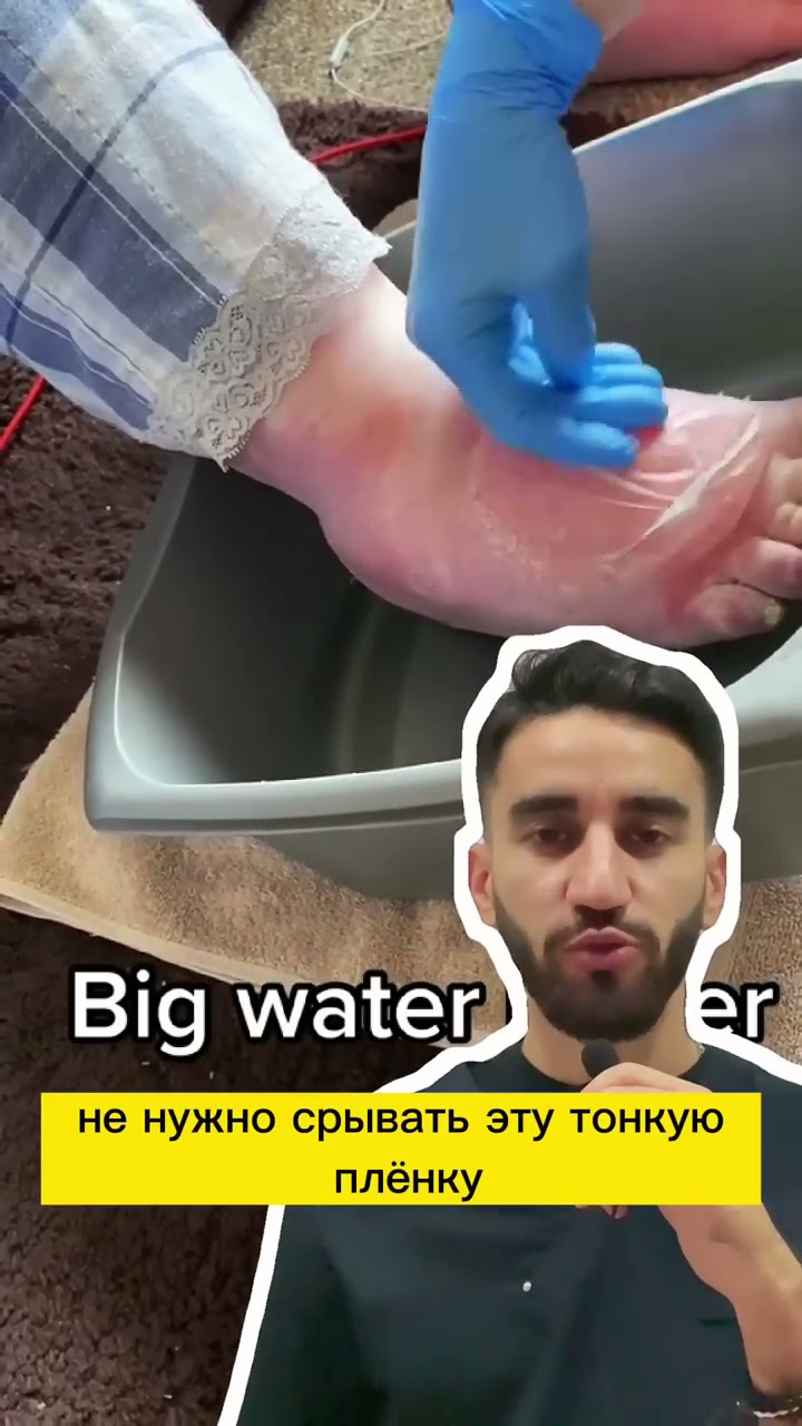 Советы для пар, как избавиться от упорного жира на животе и повысить уверенность в себе