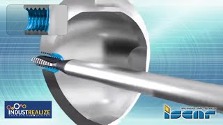 ISCAR INDUSTREALIZE - Medical - Orthopedic - Hip Joint - Shell - Thread Milling