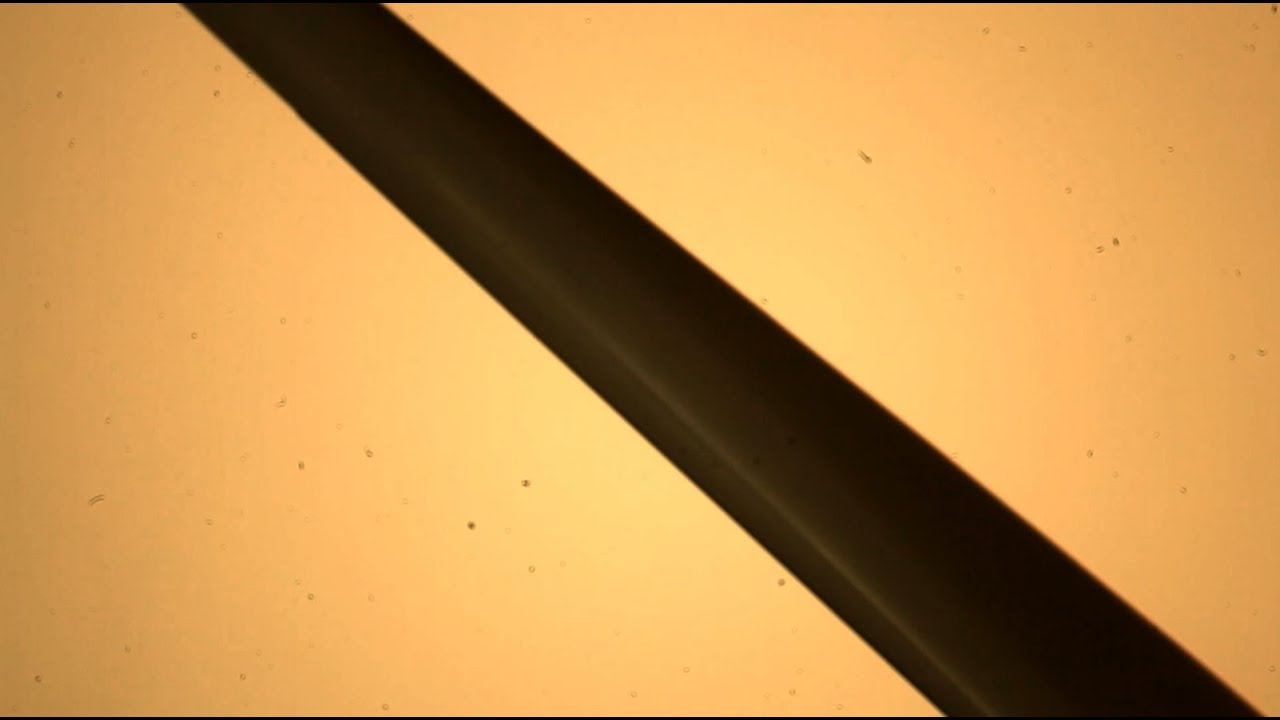 Wind Turbine Syndrome