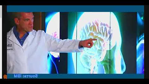 The State of Artifical intelligence in Medical field