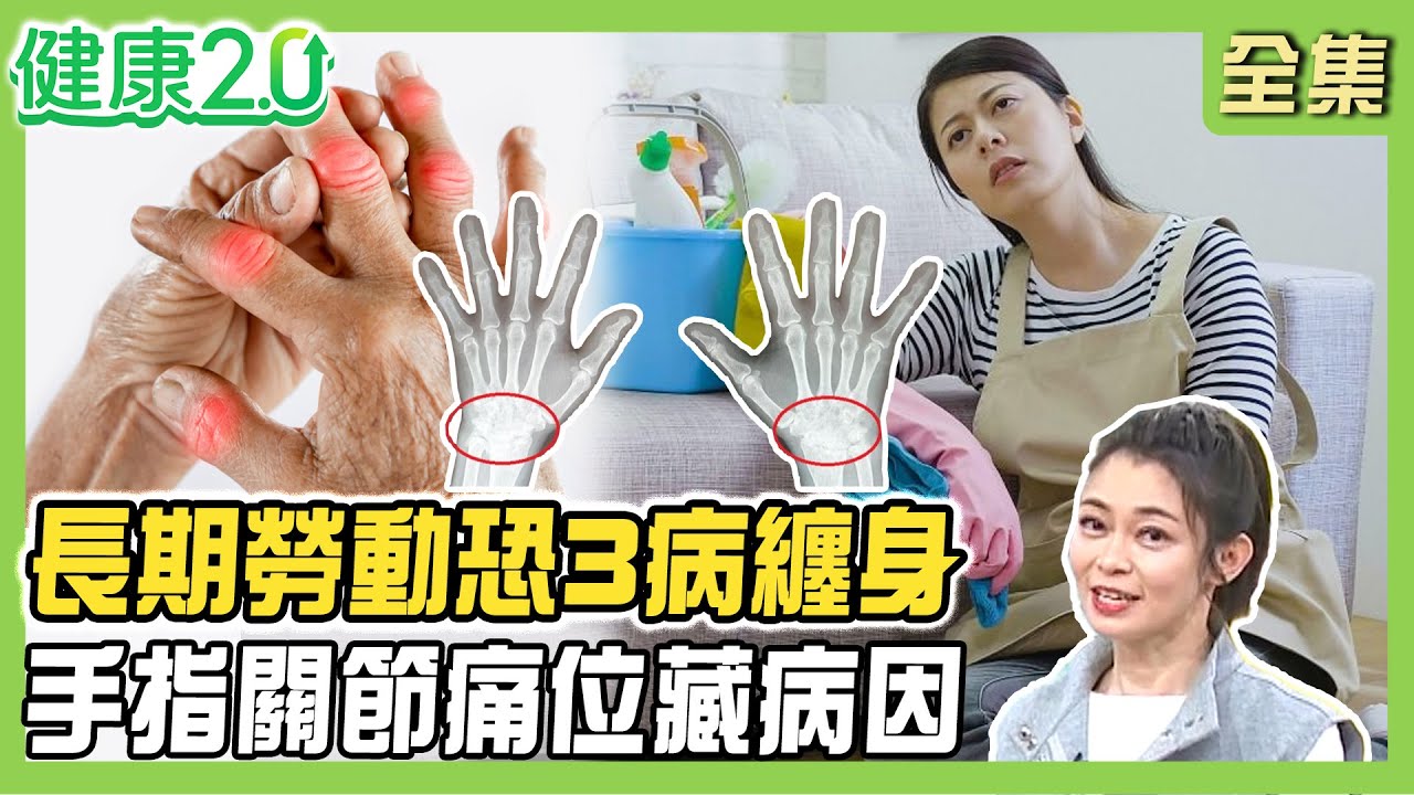 關節炎風險女性高3倍！媽媽長期勞動恐3病纏身！手指關節疼痛位置藏病因！ 晨間僵硬疑似類風濕關節炎？健康2.0 20250510【完整版】#鄭凱云 #侯鐘堡 #陳藝瑄 #陳麗華 #林勝傑
