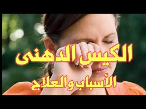 الكيس الدهنى اسبابه و الوقاية منه وعلاجه مع الدكتور