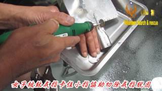 女子被鈦戒指卡住小指協助切除戒指脫困060501